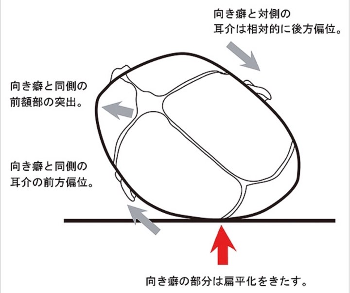 赤ちゃんの向き癖 骨格調整はーもにー